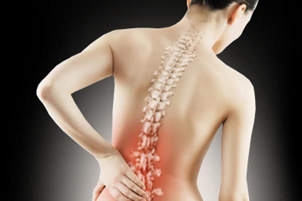 Osteoporosis Management Perth